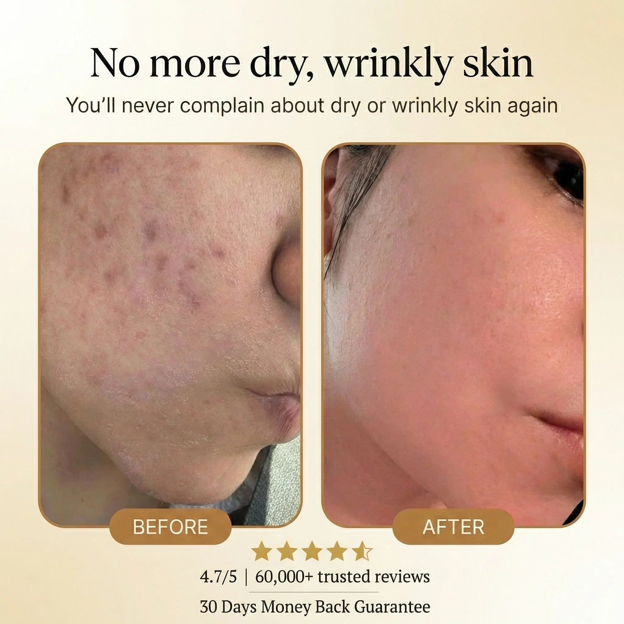 Elexine Organic Tallow Honey Balm to Help Erase Fine Lines, Wrinkles, and Age Spots