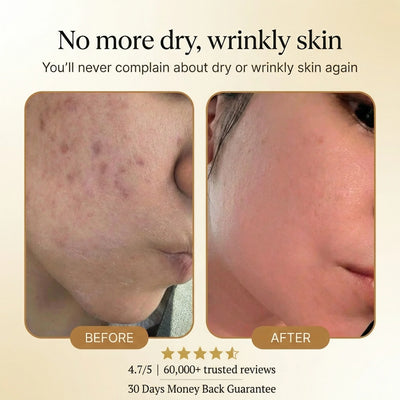 Elexine Organic Tallow Honey Balm to Help Erase Fine Lines, Wrinkles, and Age Spots
